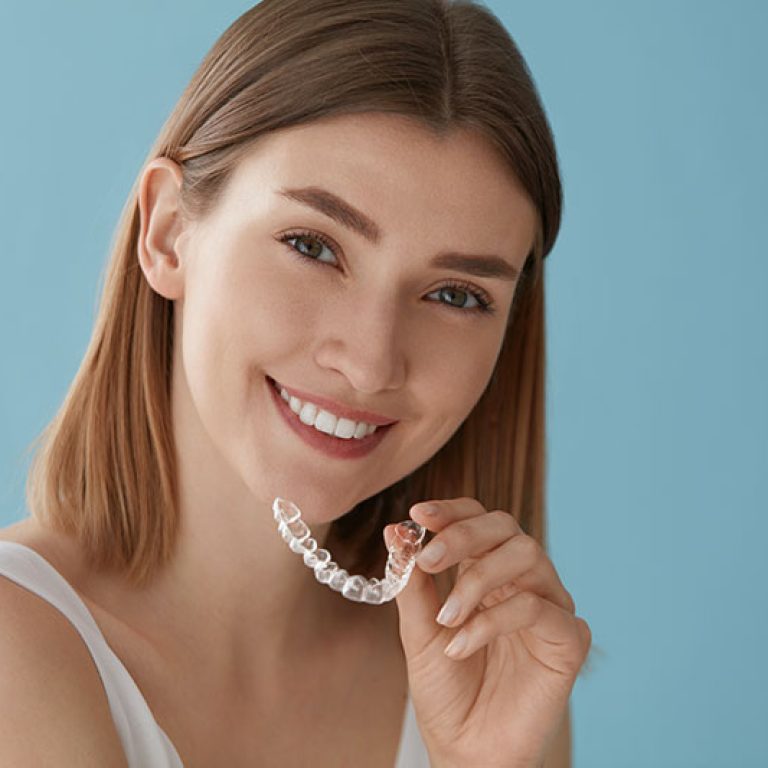 aligners-narthikes-1
